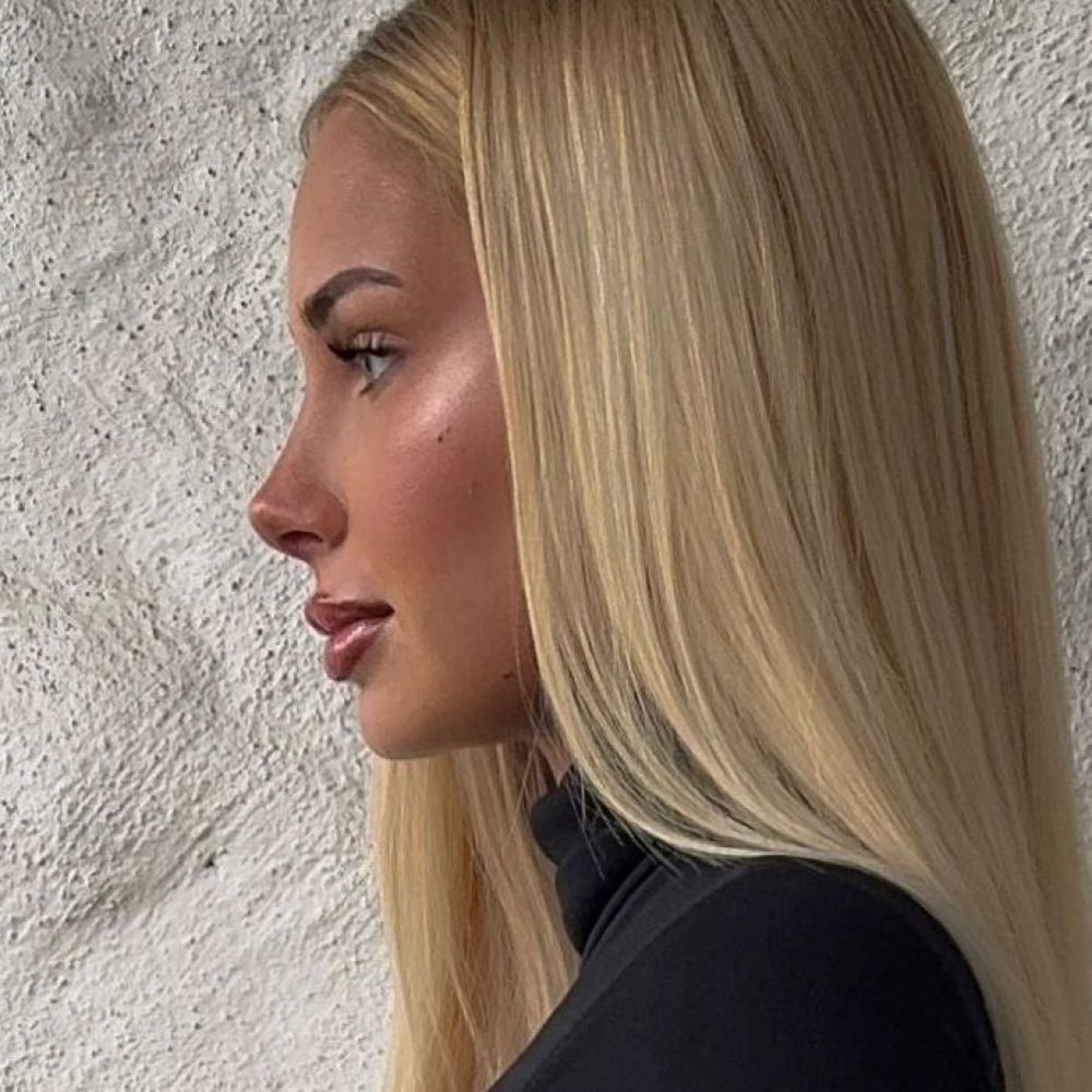 rhinoplasty-antalya-turkey-price