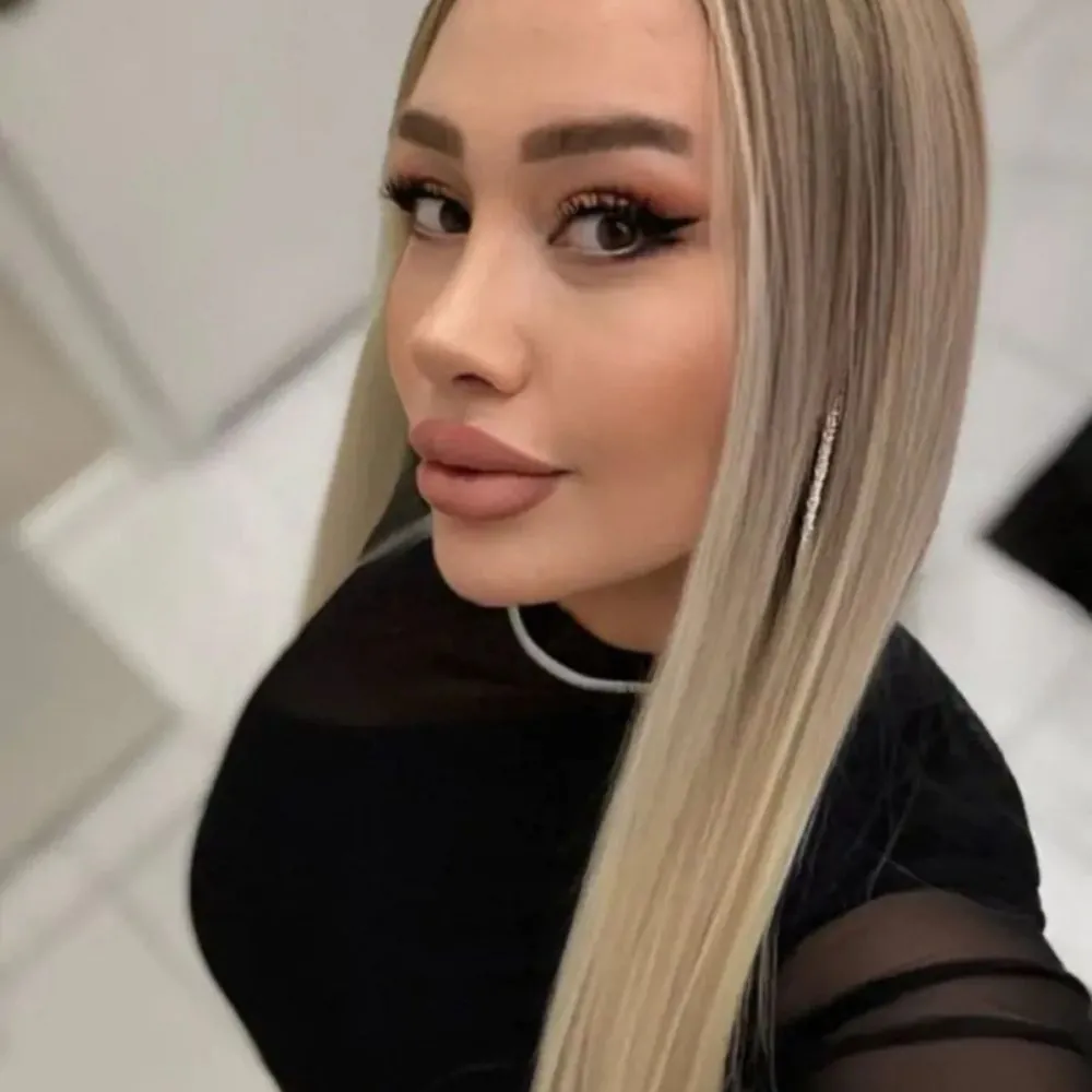 umut-erdogan-rhinoplasty